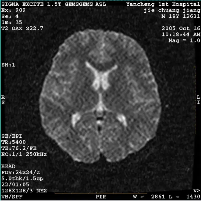 ARTEFATTO WI/Immagine Fiesta Pixel bianco